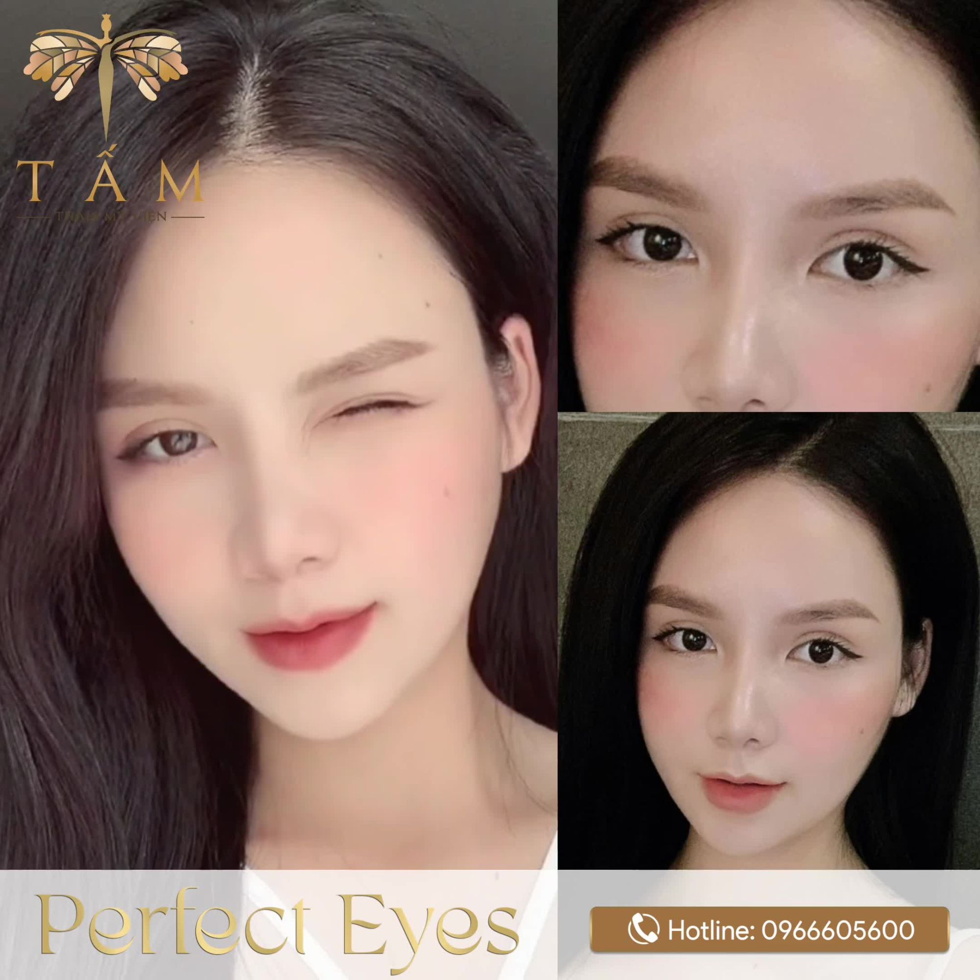 Perfect Eyes - Kiến tạo đôi mắt thần thái
