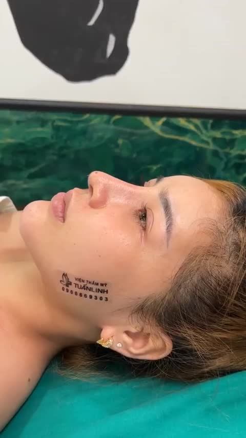 TÁI KHÁM MŨI SAU 45 NGÀY VÀ CẮT CHỈ SAU 15 NGÀY NÂNG V1.