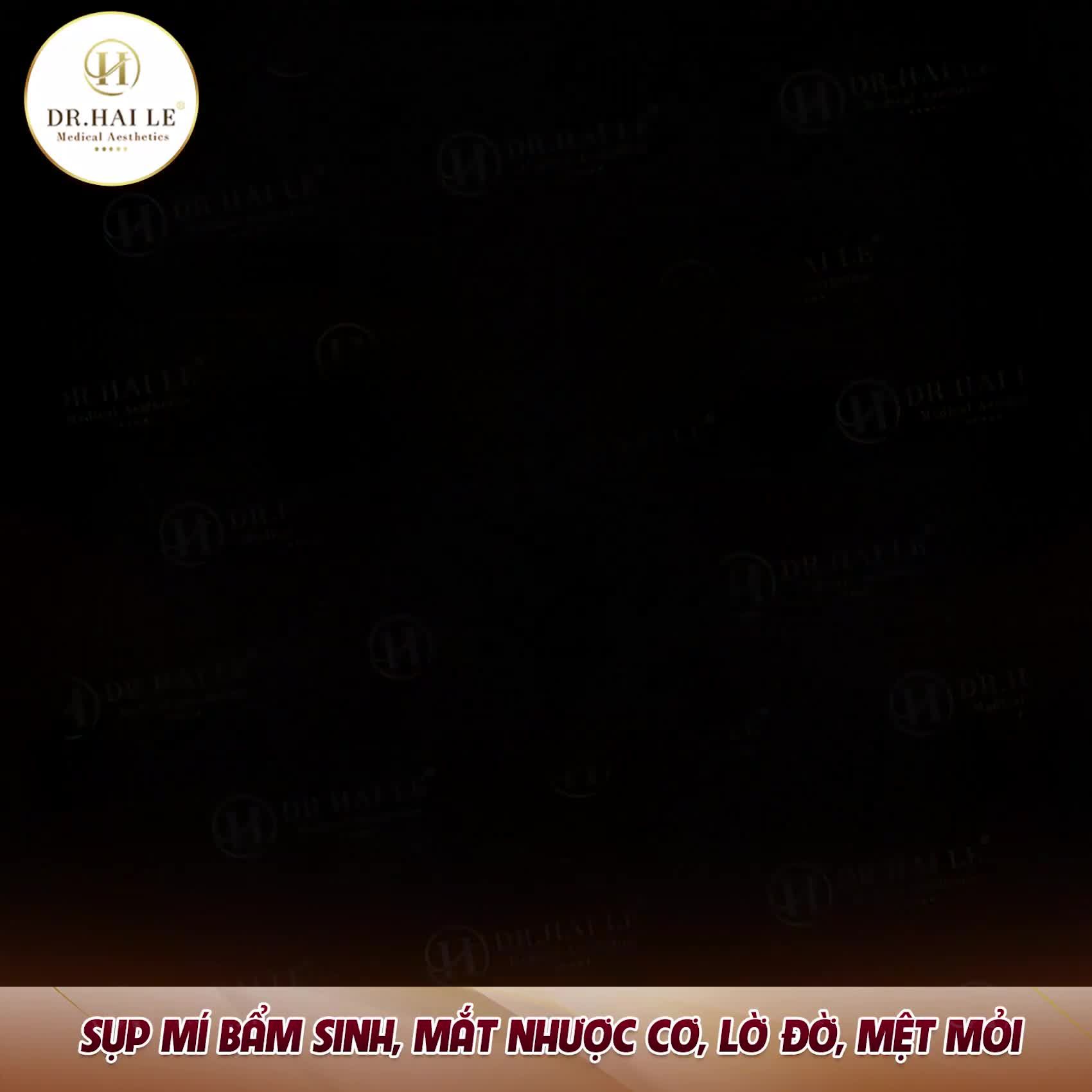 Chỉ mất 10s để show kết quả về sự biến hình này, nhưng bác sĩ đã mất tới 2 tiếng đồng hồ để chỉnh sửa, thiết lập một cơ nâng mi mới, khắc phục hoàn toàn tình trạng nhược cơ trước đó