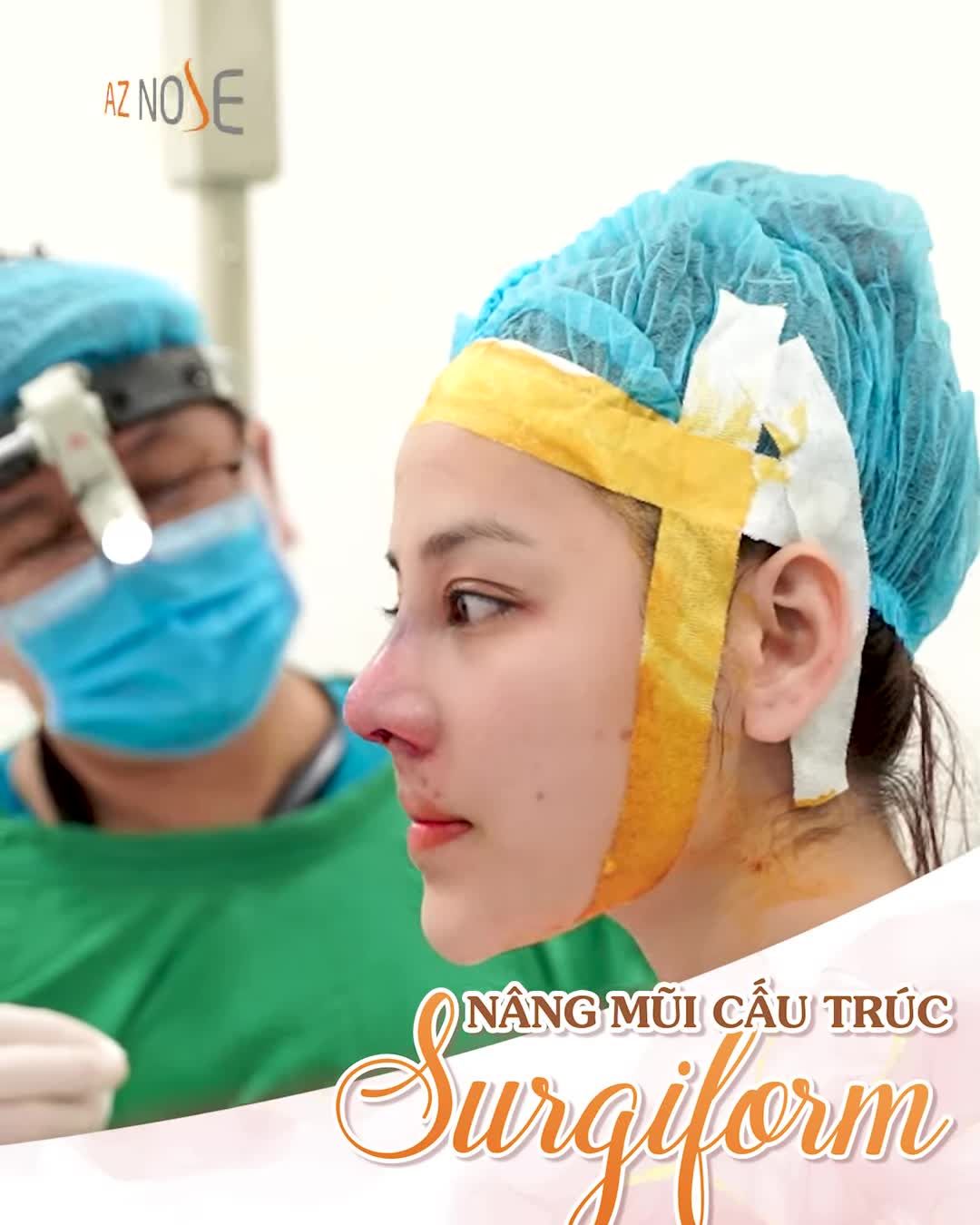 Sở hữu góc nghiêng thần thánh sau ca nâng mũi cấu trúc