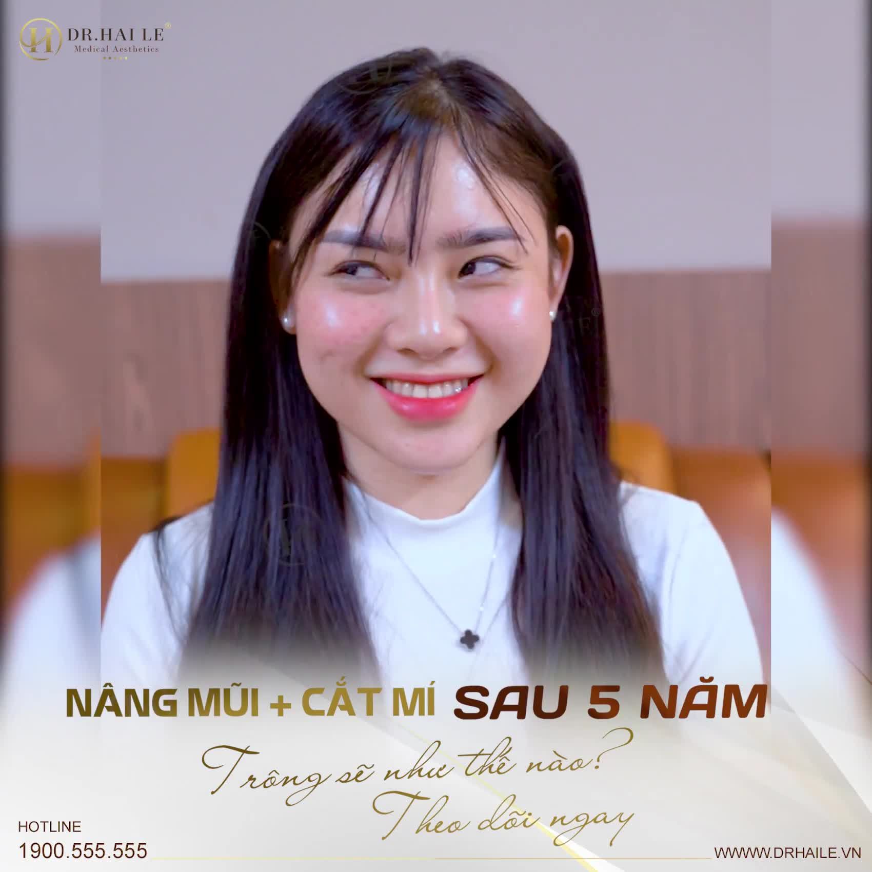 Combo Mũi + Mí sau 5 năm  Khách hàng đã có những sự thay đổi như thế nào từ nhan sắc đến cuộc sống và sự nghiệp