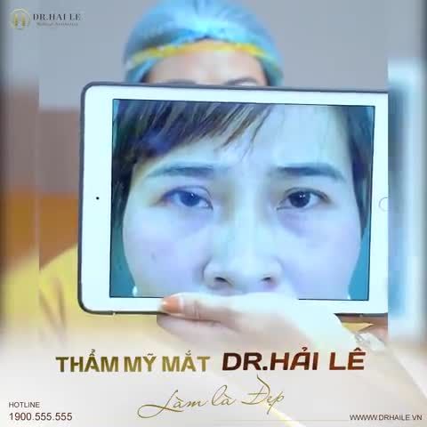 Điều gì tạo nên sự khác biệt của thương hiệu Thẩm mỹ mắt Dr.Hải Lê