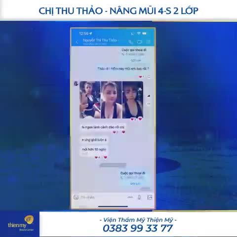 Chị Thu Thảo - Nâng mũi 4-S