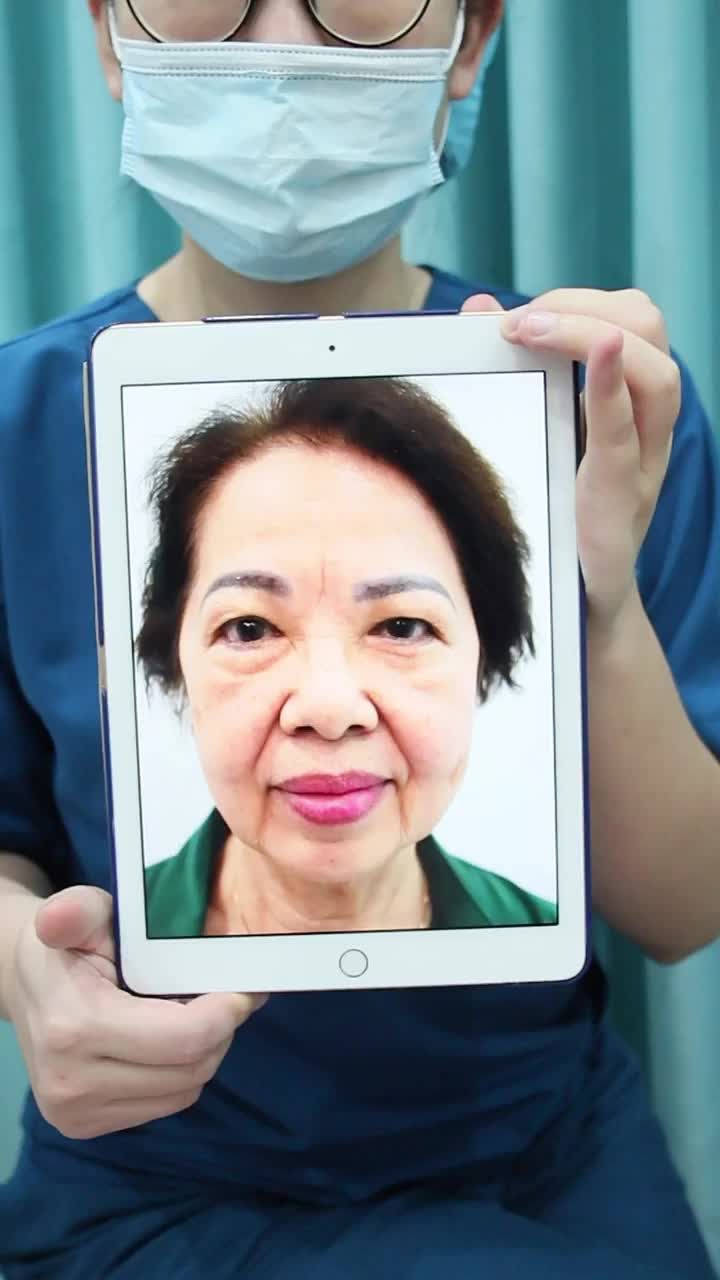 CHIÊM NGƯỠNG KẾT QUẢ SAU 30P NÂNG CUNG MÀY