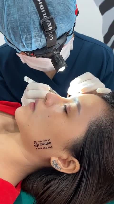 COMBO ĐỘN CẰM + CẮT MÍ SAU 8 NGÀY TÁI KHÁM