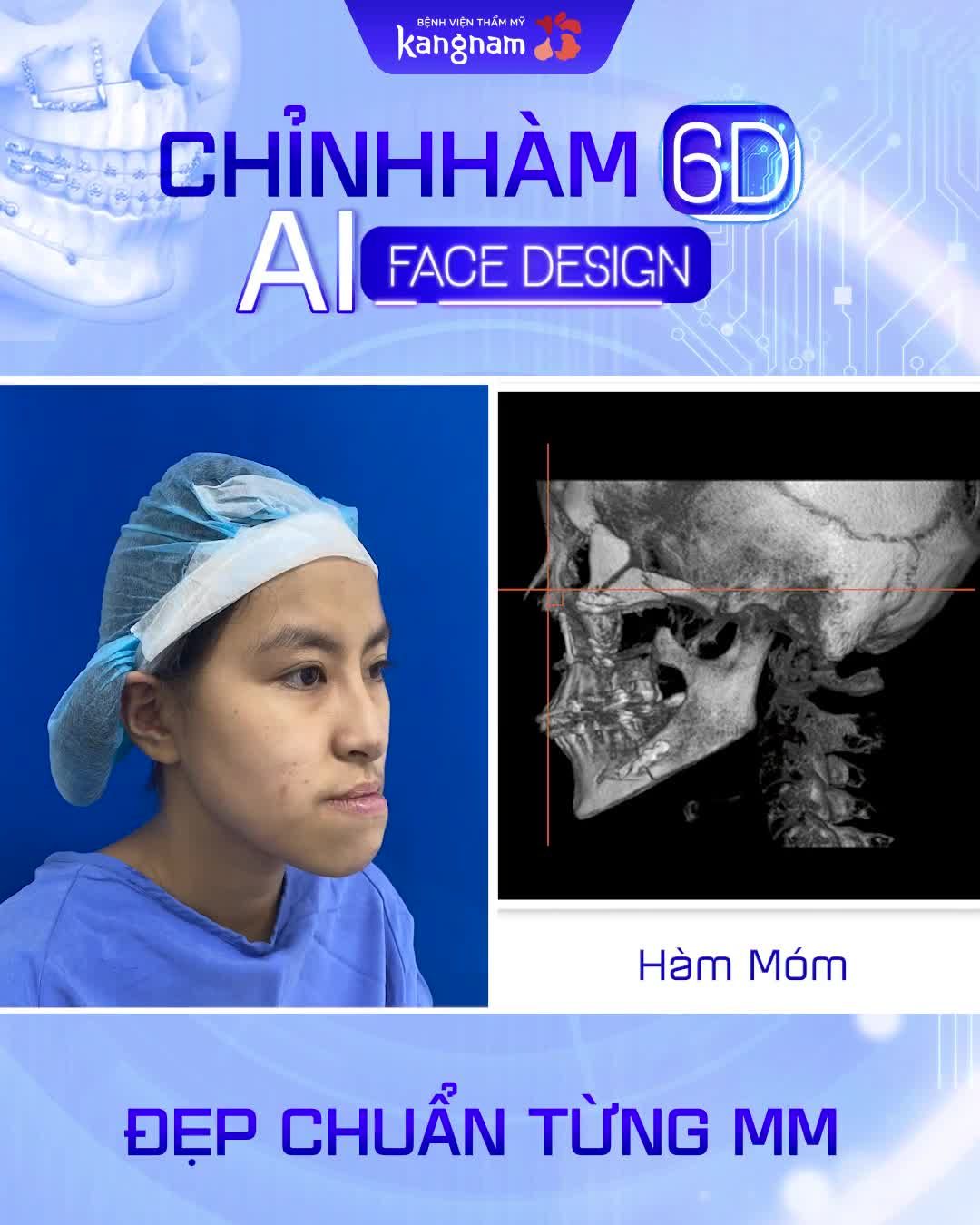 Công nghệ mô phỏng giả định - Chỉnh sửa chính xác từng chi tiết