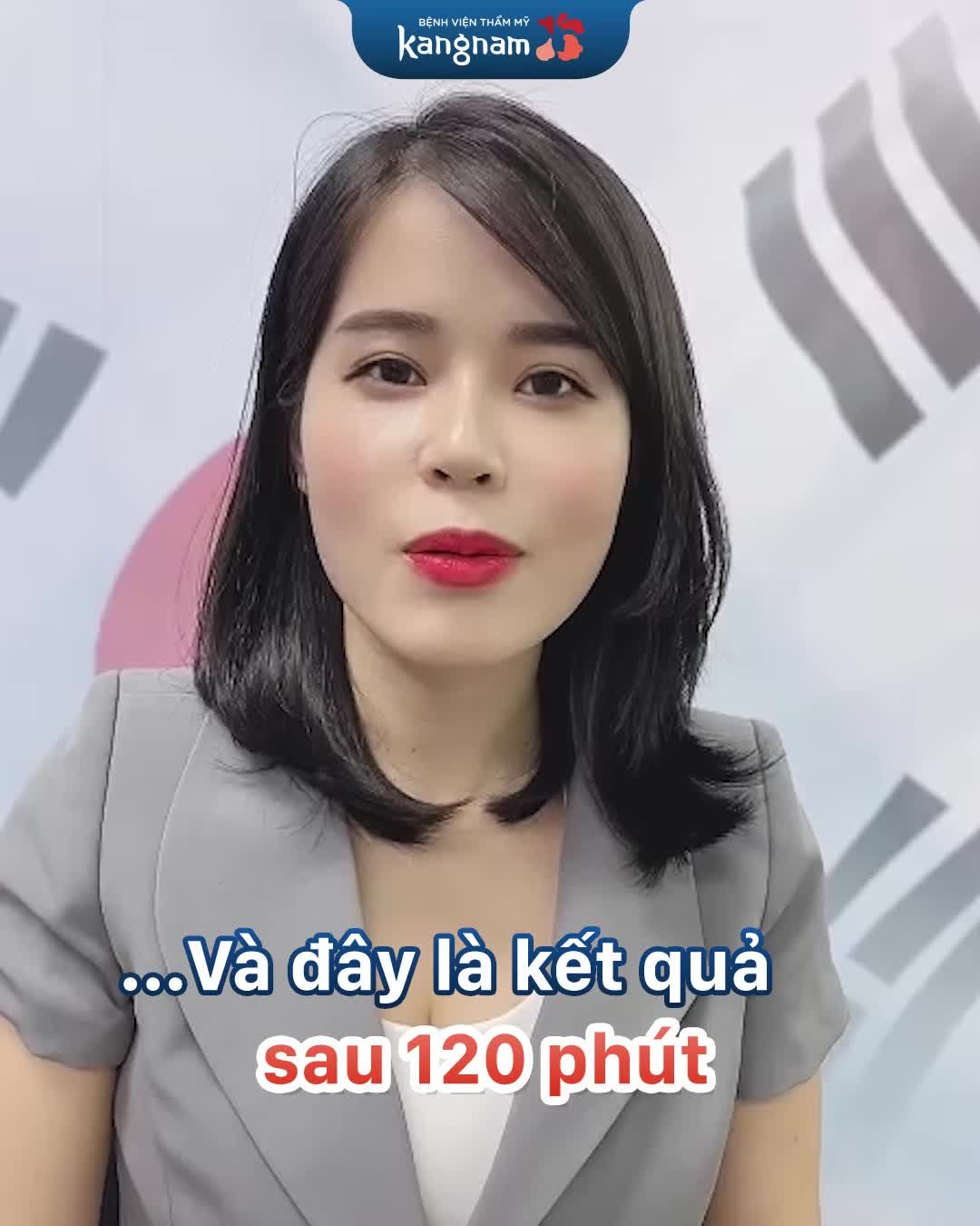 Gương mặt bầu bĩnh, tròn trịa sau cấy mỡ của chị khách hàng U30