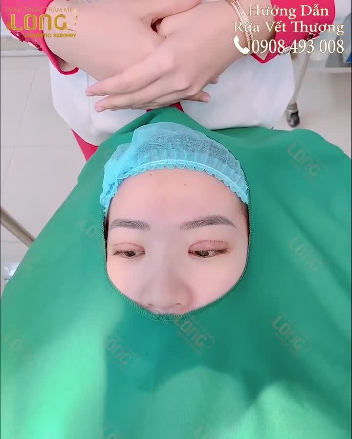 Khách hàng cắt mí mắt