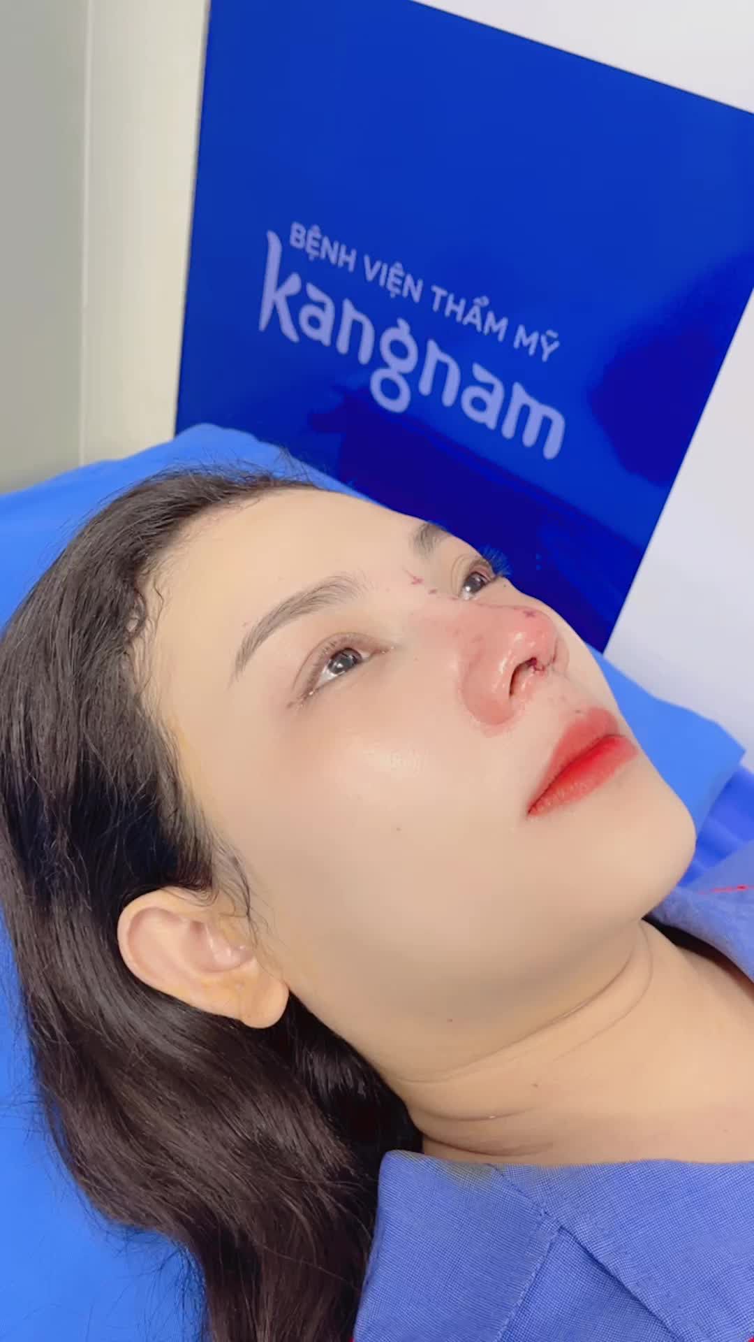 Thử thách mũi đẹp chỉ sau 30 phút thực hiện - Thử thách này quá dễ với bác sĩ Kangnam
