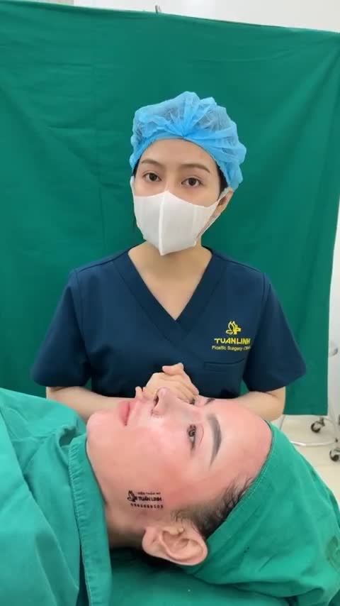 Đã từng nâng mũi cách đây 4 năm bằng phương pháp nâng mũi Hàn quốc bị lộ sống, lệch sống, đầu mũi hếch nhiều...Chị chọn nâng mũi siêu cấu trúc sửa lại tại Tuấn Linh