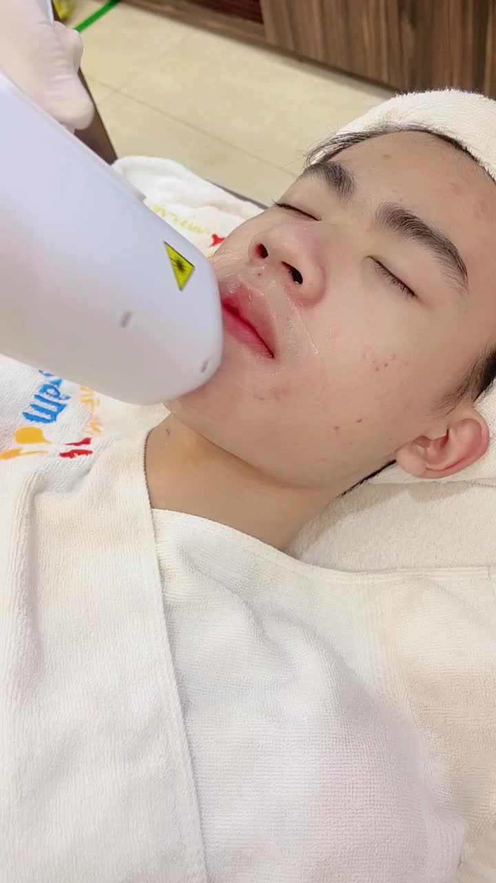 Quá trình triệt râu, ria mép cho khách hàng nam giới với công nghệ Diode Laser tại Kangnam