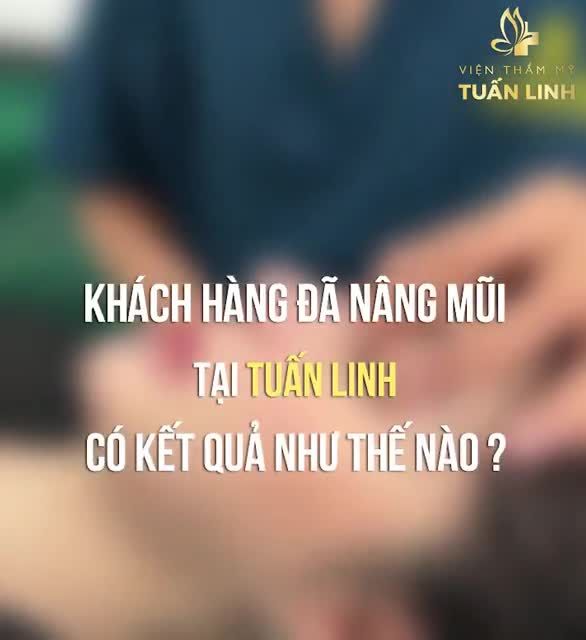 Clip dành cho ai thắc mắc nâng mũi xong nhìn có khác không ? Nâng mũi tại Tuấn Linh sẽ có kết quả như thế nào?