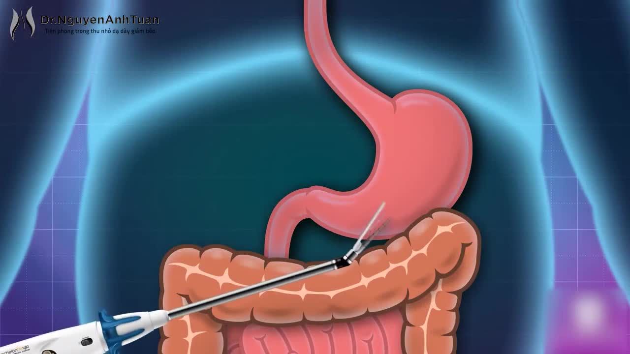 Niềm tin, sự quyết đoán đã giúp bệnh nhân của chúng tôi mở ra một trang mới của cuộc sống.