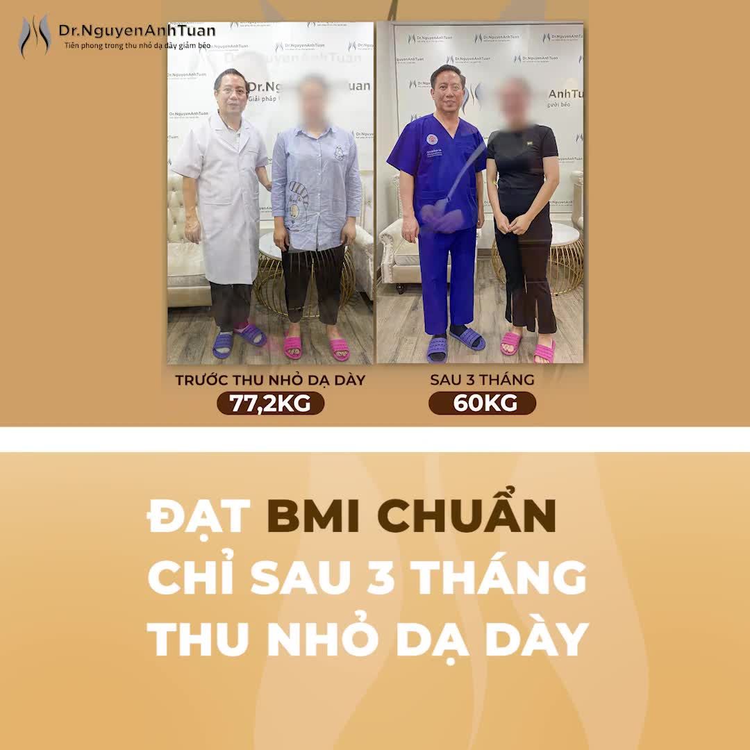 Từ mức BMI trên 30 (béo phì độ 2), sau 3 tháng thực hiện phương pháp phẫu thuật nội soi thu nhỏ dạ dày để giảm béo