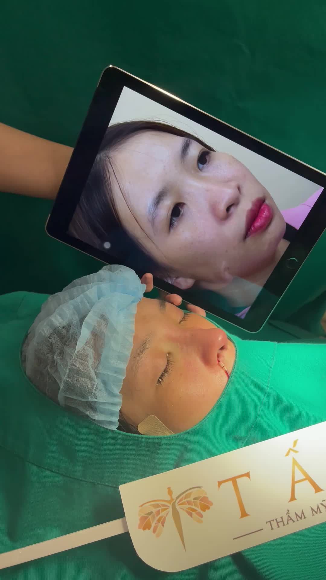 Ai là fan mũi cao tự nhiên không thể bỏ qua live này nhé!!