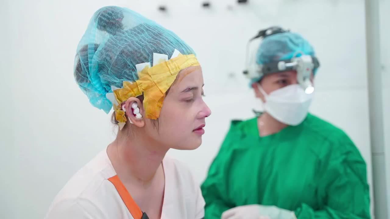 Ca nâng mũi cấu trúc sụn tai