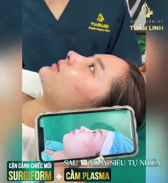 Combo cho khuôn mặt đẹp không góc chết!!