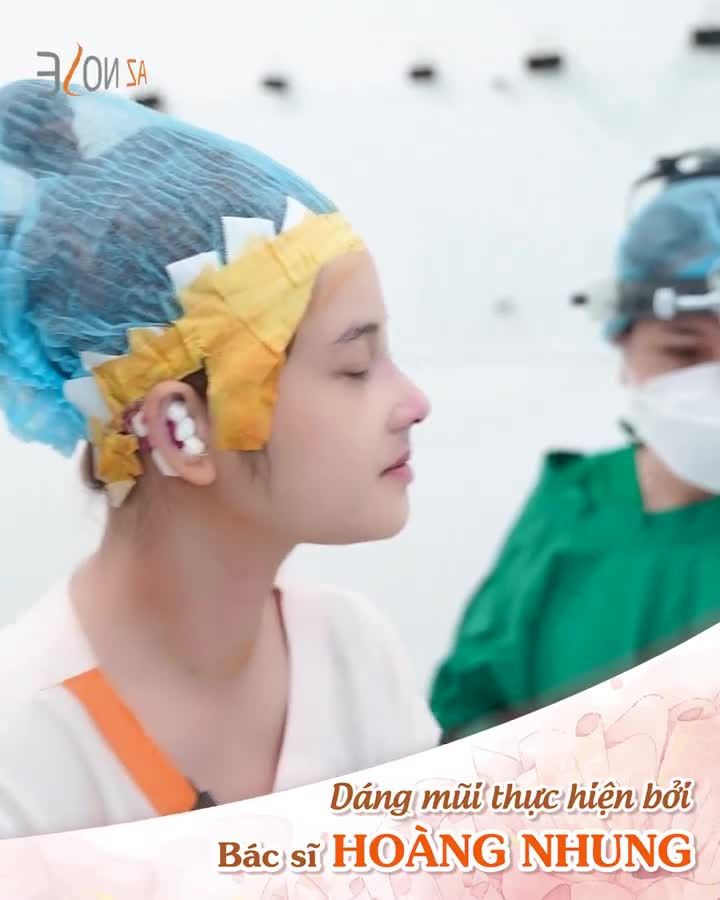 Khách hàng Kiên Giang ưng ý với dáng mũi mới