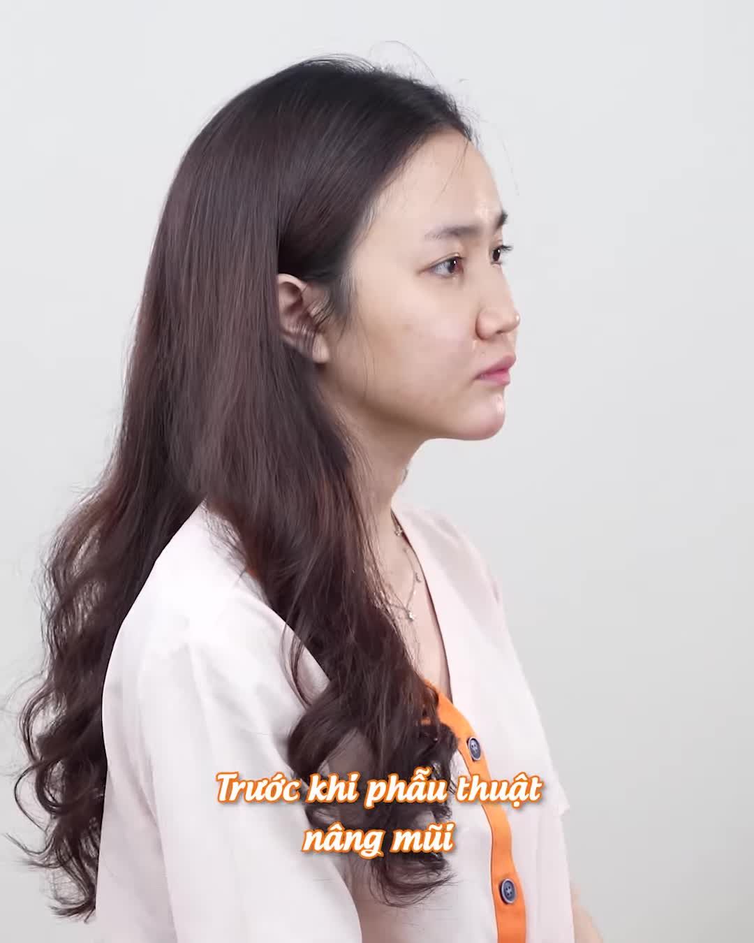 Từ cảm giác tự ti đến nụ cười rạng rỡ