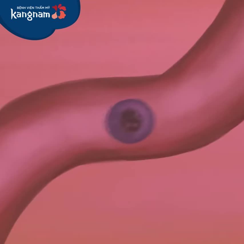 Biết nguyên nhân để Trị tàn nhang và chăm sóc da sau điều trị Laser đúng cách.