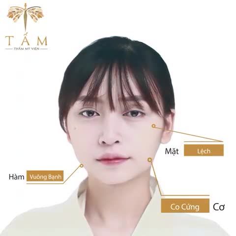 VLINE PERECT Thon gọn hàm - Chìa khoá mở lối nhan sắc
