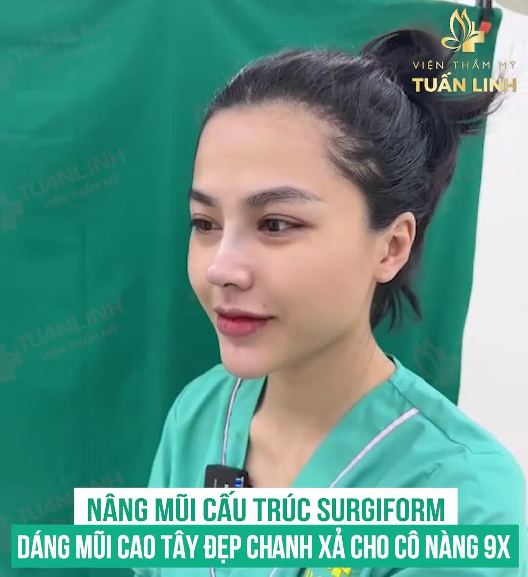 DÁNG MŨI CAO SANG, ĐẸP MỌI GÓC NHÌN CHỈ SAU 90 PHÚT THỰC HIỆN!!!