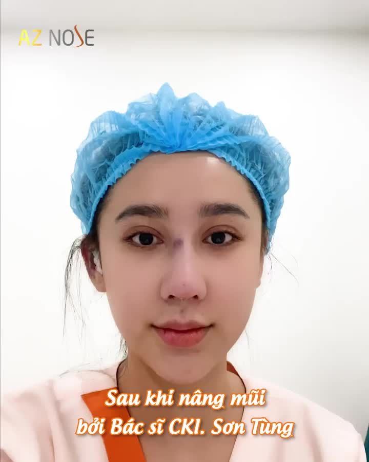 Dáng mũi quyết định 70% vẻ đẹp trên khuôn mặt là có thật
