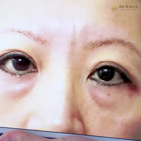 Lý do tại sao các tín đồ làm đẹp phía Nam chọn Dr.Hải Lê thực hiện các dịch vụ làm đẹp thẩm mỹ
