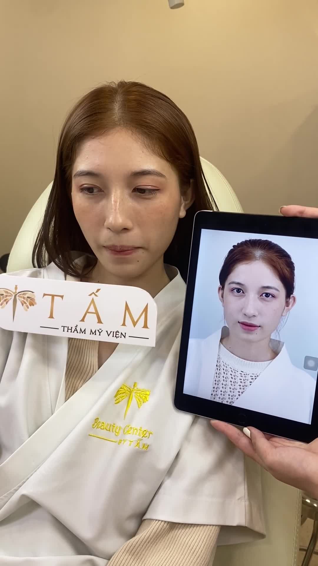 Sài Gòn Cả nhà cùng xem sự thay đổi trước sau của chị khách nhà Tấm sau 1 tháng làm Vline Perfect nhé