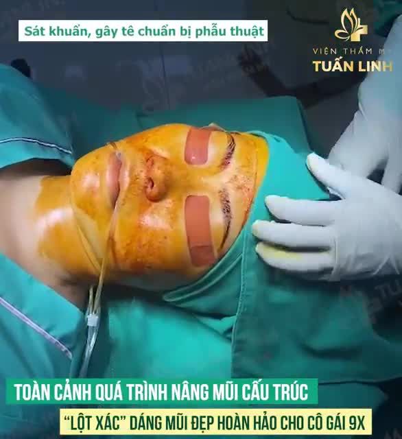 HÀNH TRÌNH 90 PHÚT LỘT XÁC DÁNG MŨI CHO CÔ NÀNG 9X