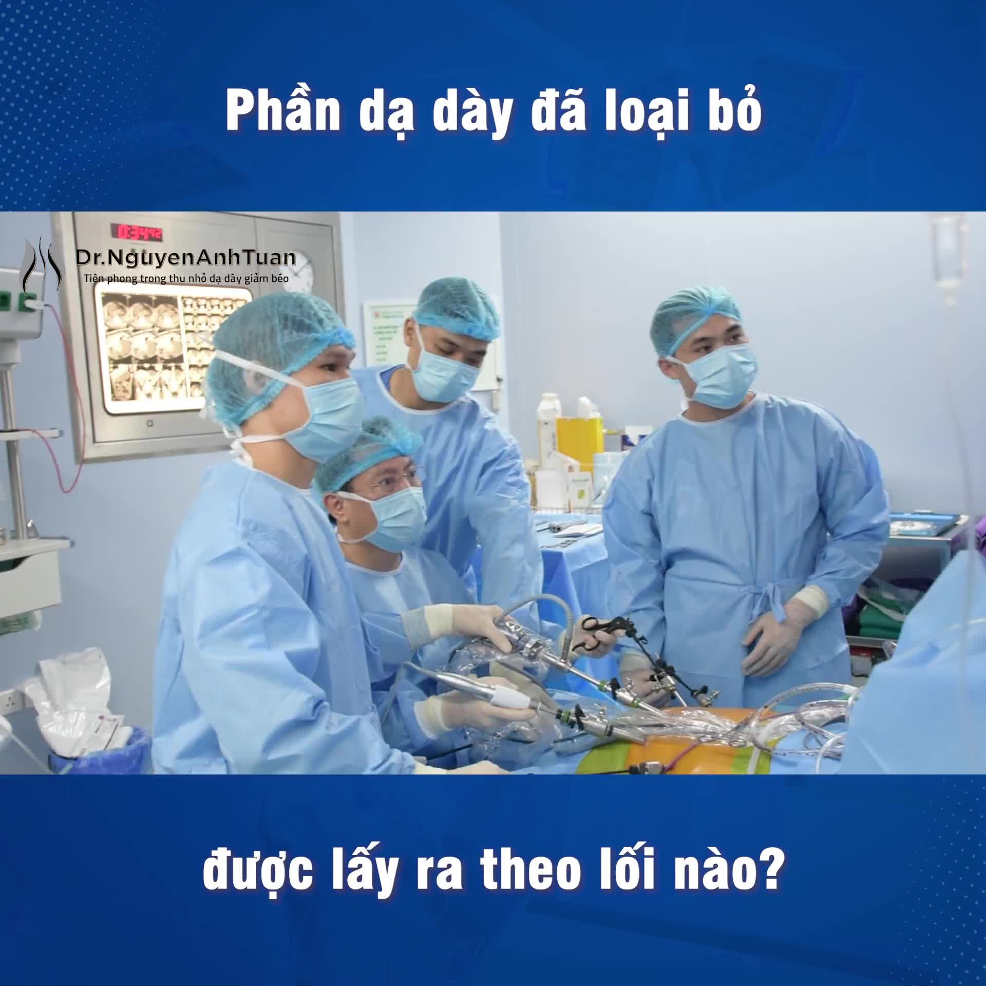 Bạn có bao giờ thắc mắc, phần dạ dày sau khi được cắt bỏ thì bác sĩ sẽ lấy ra khỏi ổ bụng như thế nào không, trong khi các lỗ trocar có kích thước rất nhỏ (chỉ từ 0,5-1,5cm)