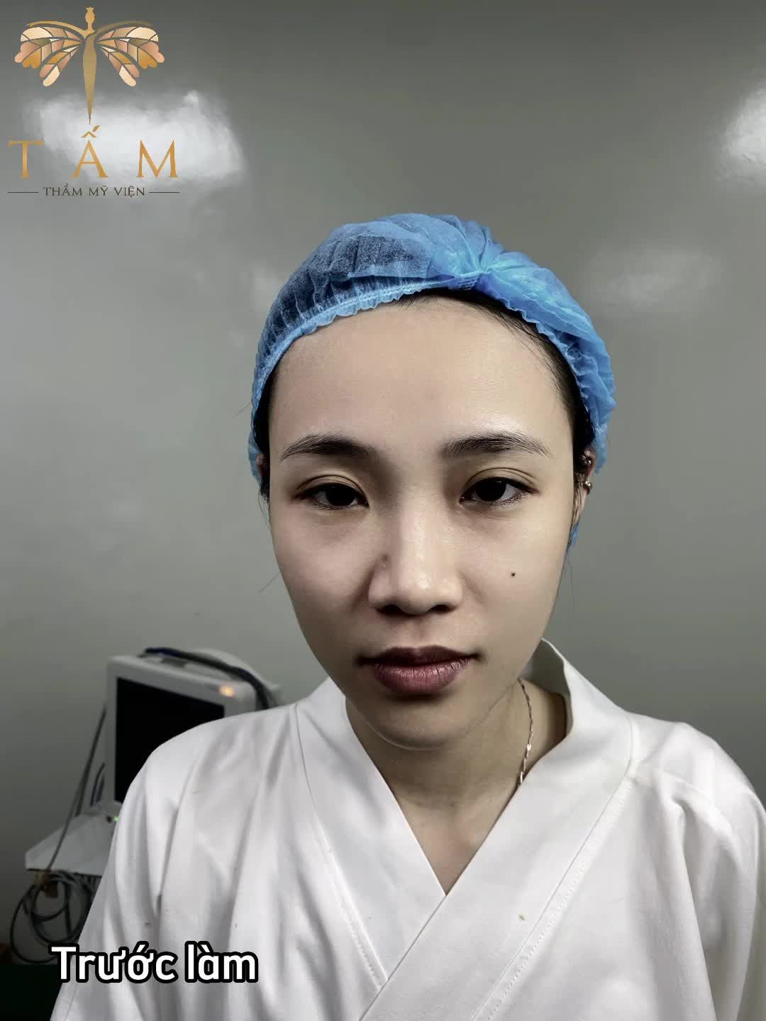 Check it out top các ca hoá hot girl sau nâng mũi Tái cấu trúc Reform