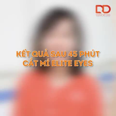 Cùng theo chân bạn khách hàng Lê Mai khám phá bên trong phòng phẫu thuật để theo dõi quy trình phẫu thuật Cắt mí sẽ được thực hiện như thế nào nhé!
