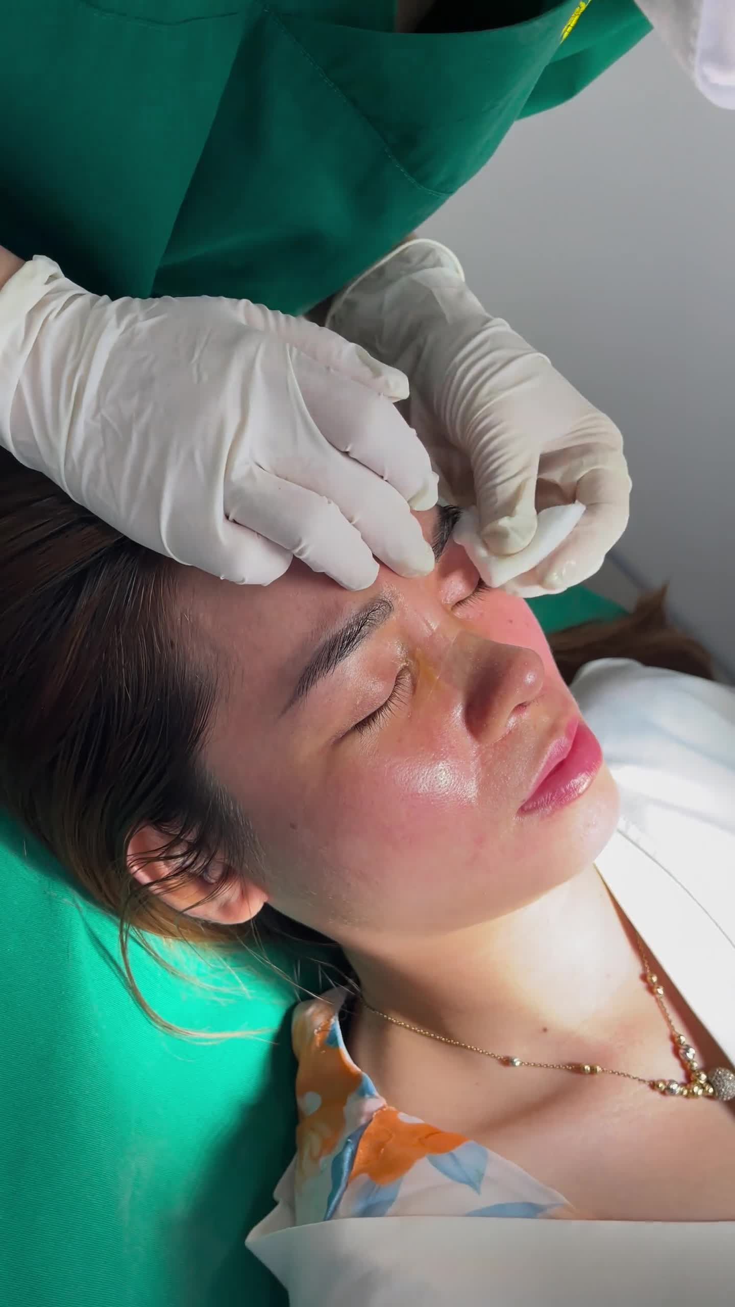Khoảnh khắc tháo nẹp đáng mong chờ nhất của nàng khách hàng nâng mũi nhà Tấm. Sẵn sàng đẹp bất chấp nhé khách ơi!