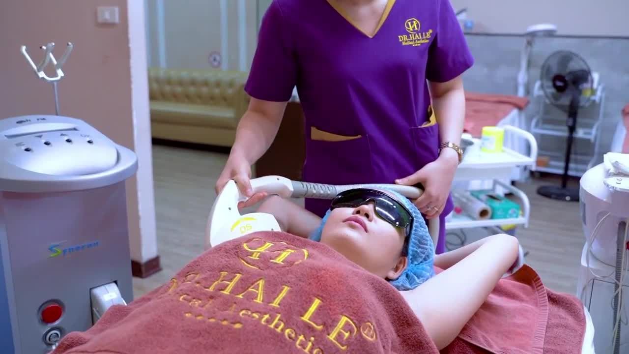 Triệt lông vùng nách hiệu quả an toàn bằng công nghệ ánh sáng Elos tại Dr.Hải Lê