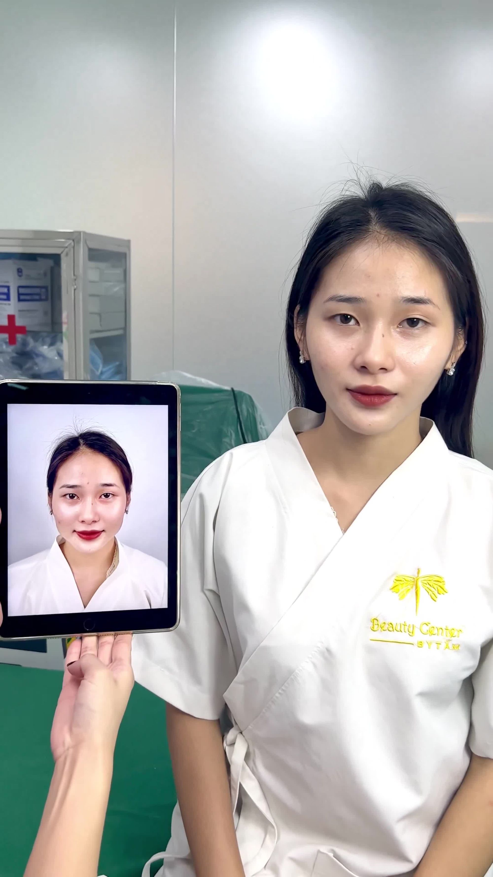 Ca Vline Perfect sau hơn hai tháng quay lại tái khám tại TMV Tấm