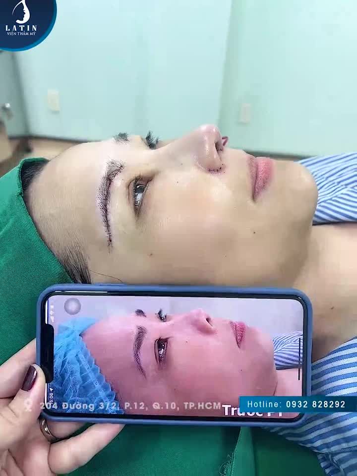 Thay đổi diện mạo ngày xưa - Sở hữu nhan sắc tươi trẻ