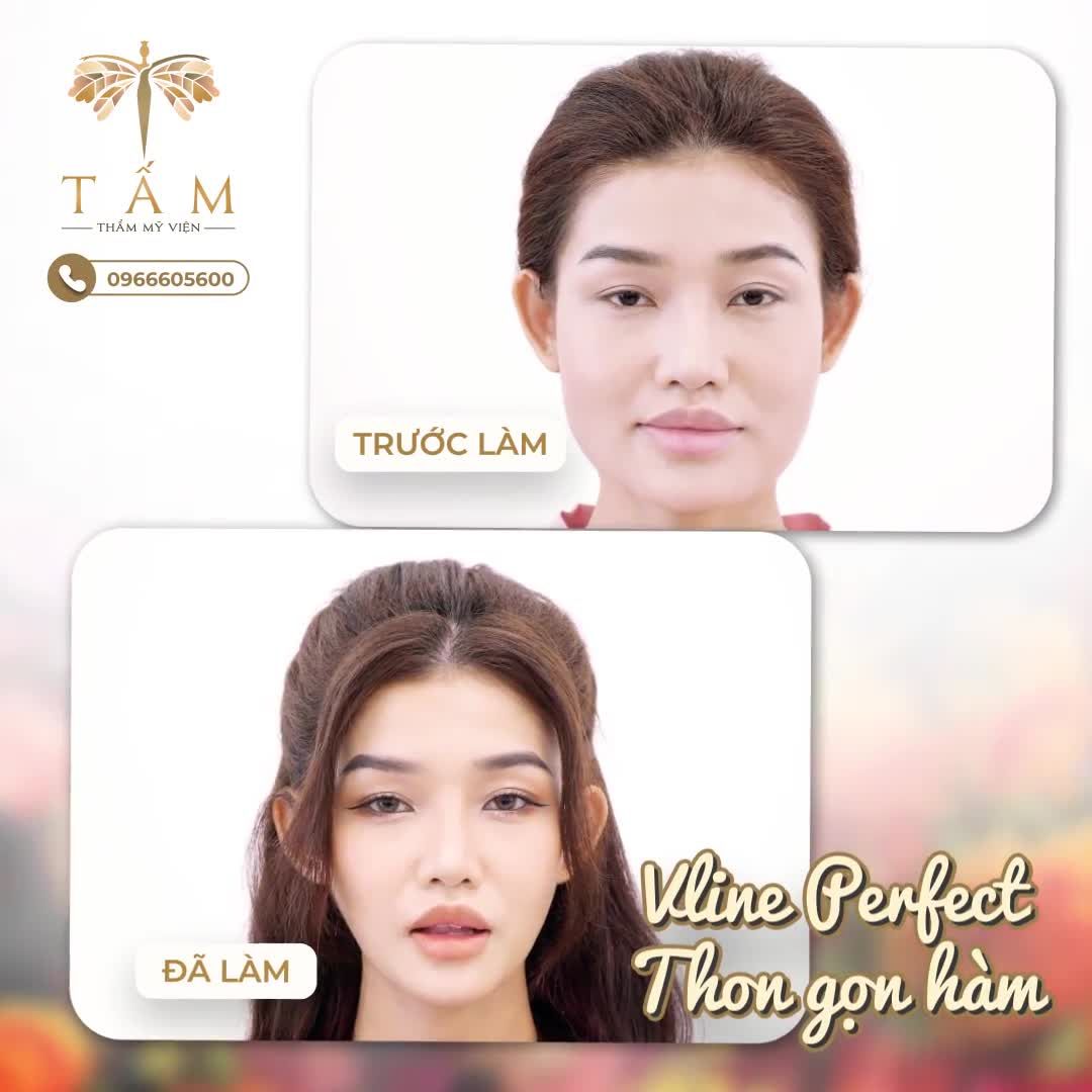 LỘT XÁC được định nghĩa như thế nào