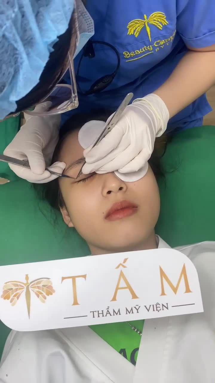 Khách hàng quay lại tái khám sau 6 ngày làm Cắt mí Line Mini tại TMV Tấm.