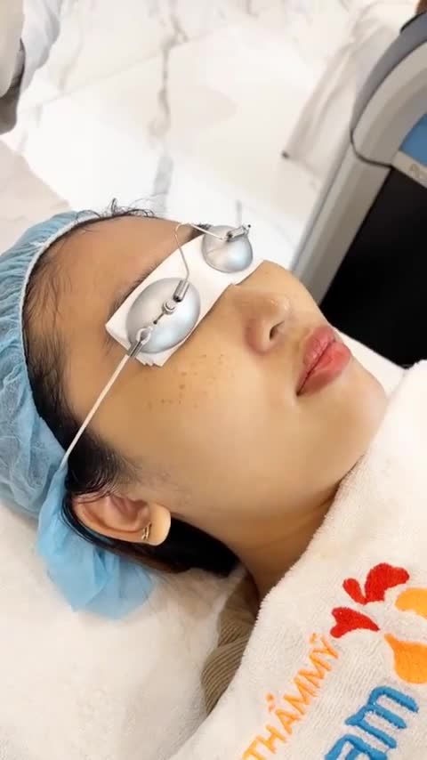 Trị tàn nhang chỉ mất 1,2 buổi, vậy có gì trong buổi điều trị đầu tiên