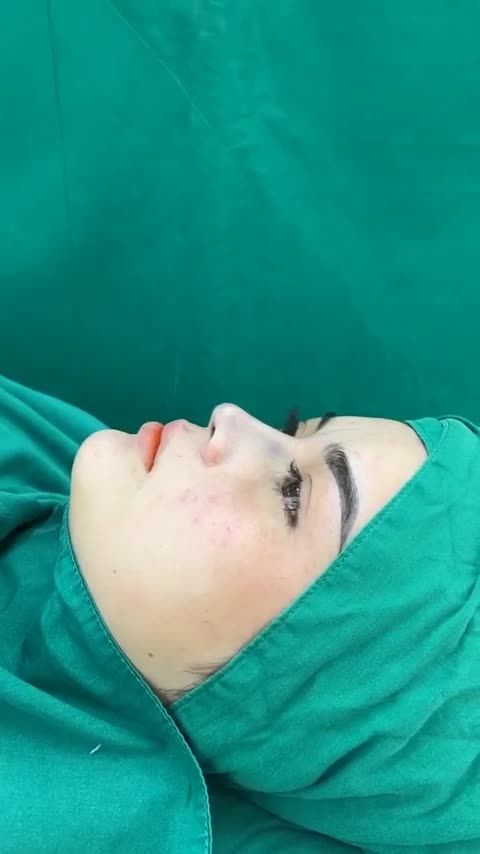 BA CHỊ EM RỦ NHAU ĐI NÂNG MŨI TẠI TUẤN LINH... VÀ QUÁ ƯNG Ý SAU 60 PHÚT.