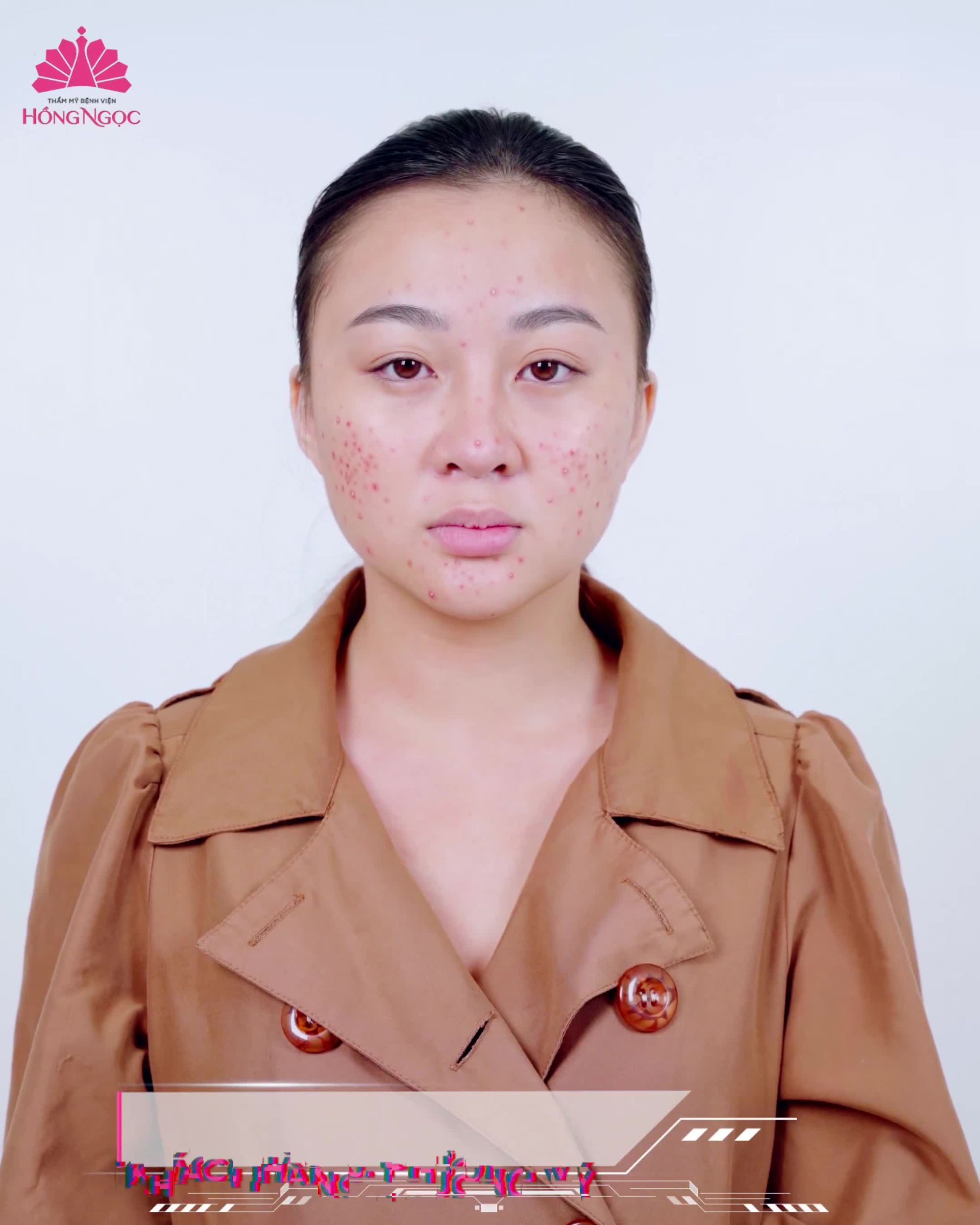 Chấm dứt ''duyên nợ'' với MỤN - Tiktoker Phượng Vy khoe nhan sắc xinh như NÀNG THƠ