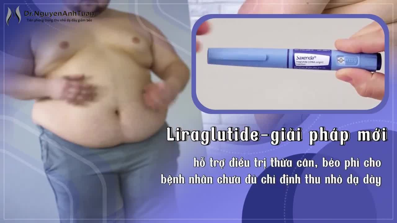 Liraglutide - giải pháp mới hỗ trợ điều trị thừa cân, béo phì cho bệnh nhân chưa đủ chỉ định thu nhỏ dạ dày.