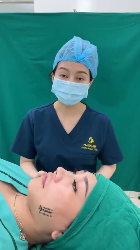 Tiếp tục một ca nâng mũi bọc sụn vừa hoàn thành tại viện!!!