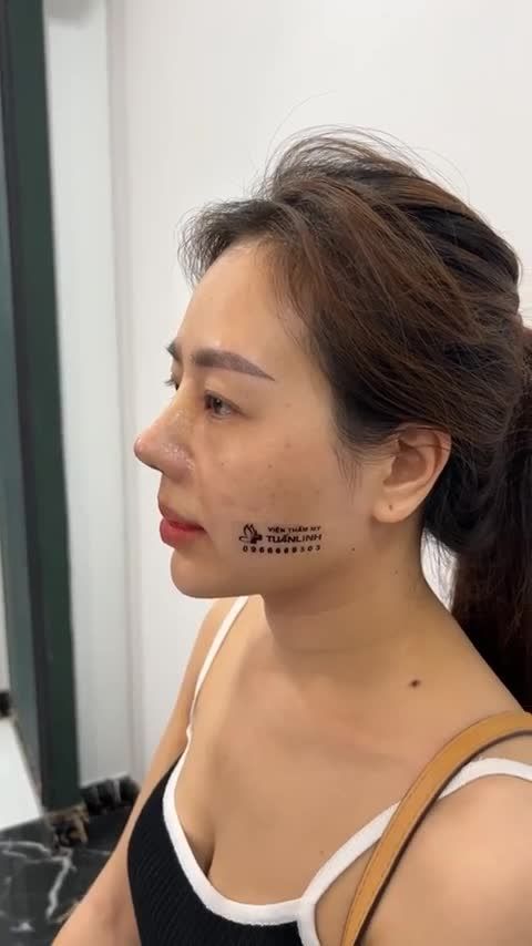 MUỐN TRẺ HƠN, ĐẸP HƠN NÊN CHỌN ĐI NÂNG MŨI ĐỂ CẢI THIỆN NHAN SẮC