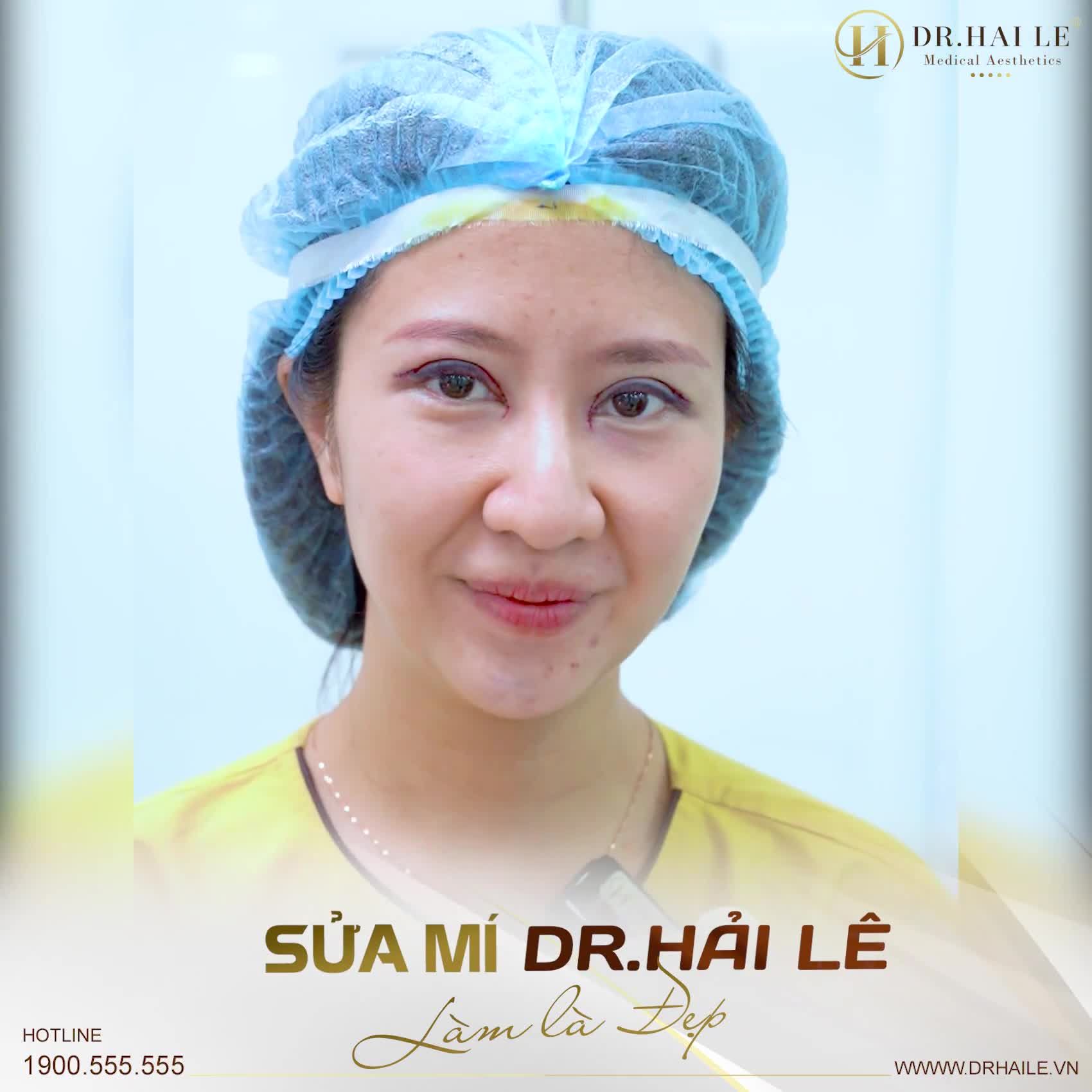 Cắt mí Dr.Hải Lê Tiểu phẫu nhẹ nhàng - Làm là đẹp!
