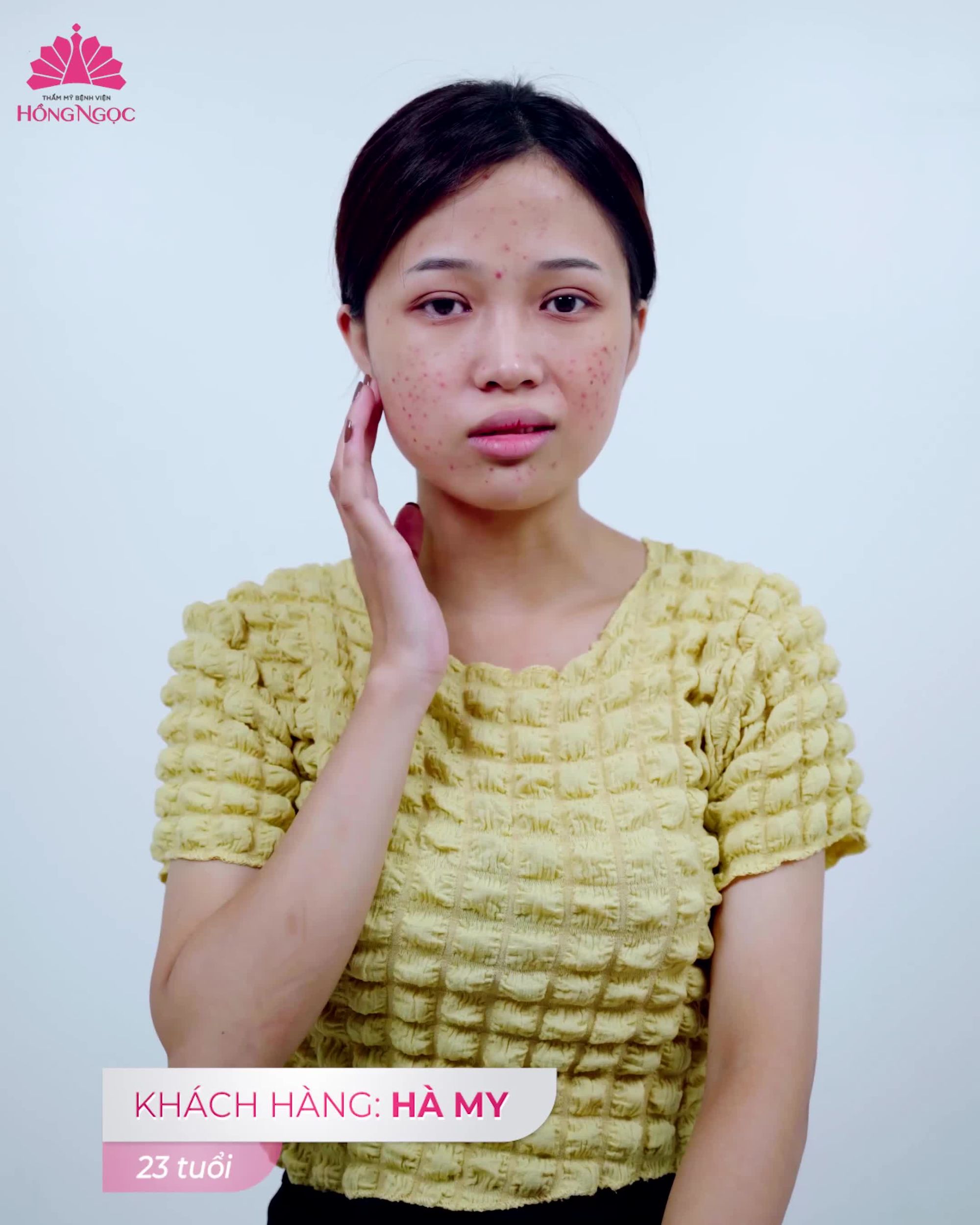 MỤN DAI DẲNG CHỮA MÃI KHÔNG DỨT PHẢI LÀM SAO