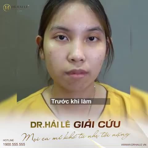 Dr.Hải Lê giải cứu mọi ca mí lỗi hỏng từ nhẹ tới nặng