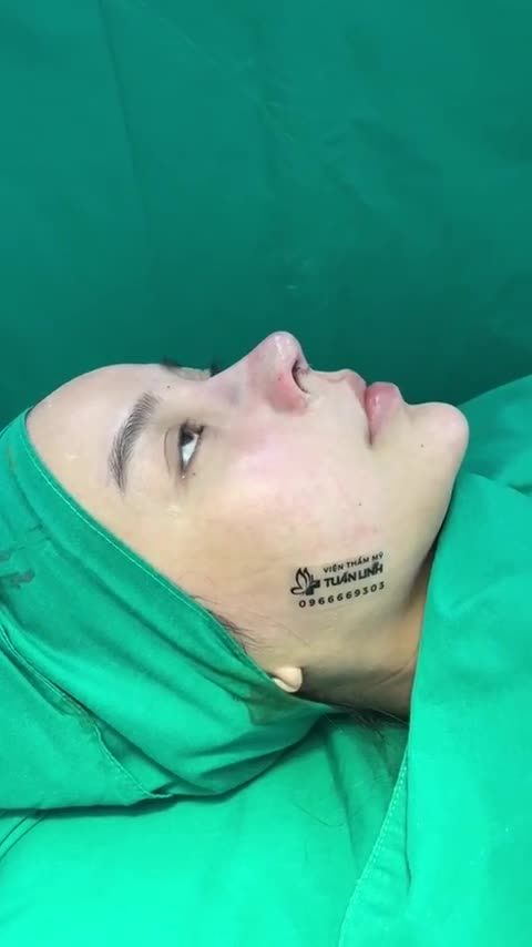Mũi cấu trúc sửa lại + cuộn cánh mũi vừa mới hoàn thàn U mê quá đi thôi