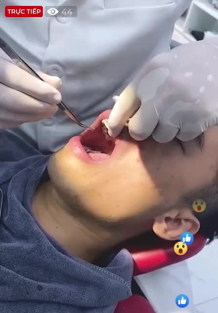 Bác sĩ thực hiện gắn mắc cài Kim loại  cho anh khách hàng.